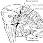 Previous Attachment