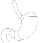 Next Attachment